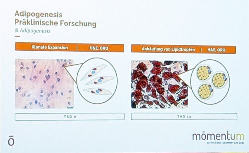 Abnehmen mit ätherischen Ölen Einlagerung von Lipidtröpfchen in Fettzellen